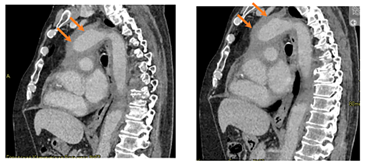 Сагиттальная проекция