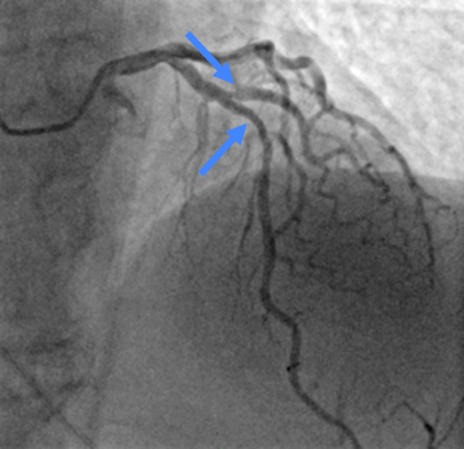 Вид кровотока