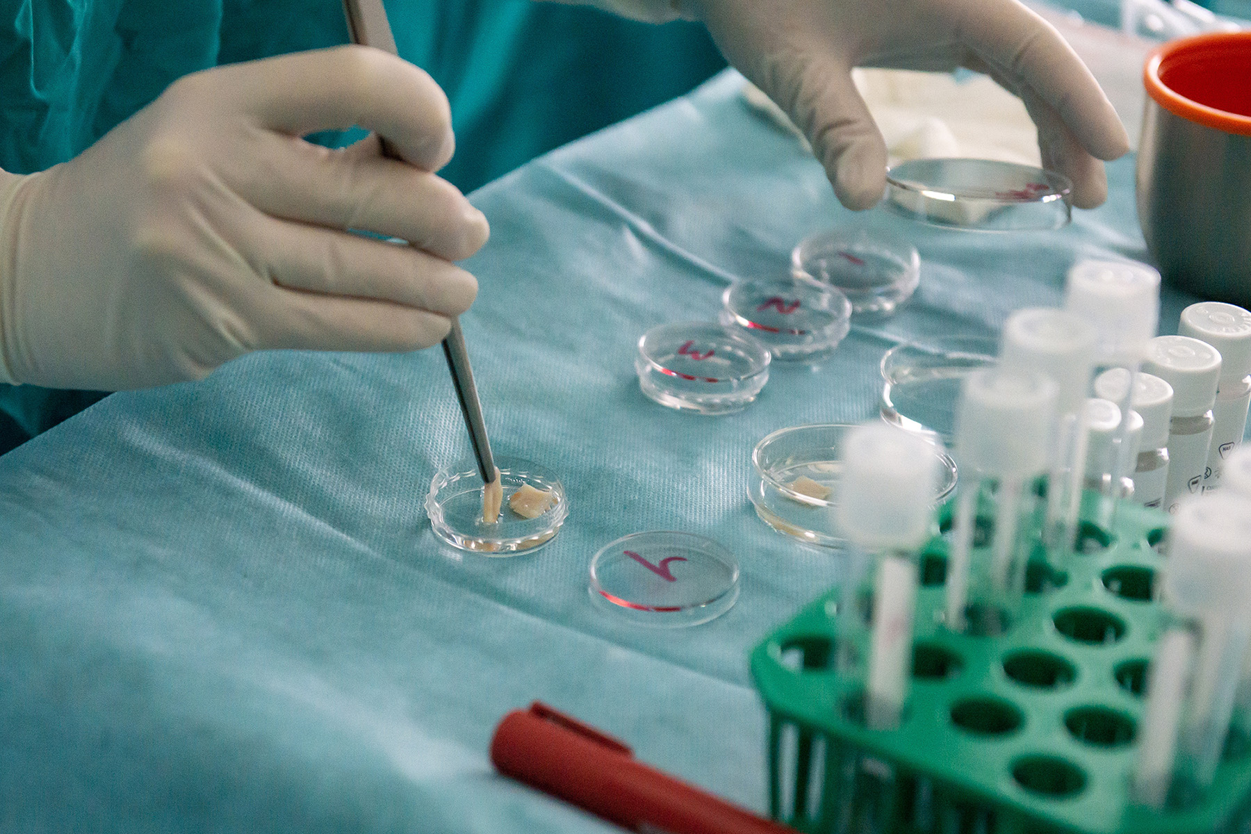 Во время операции