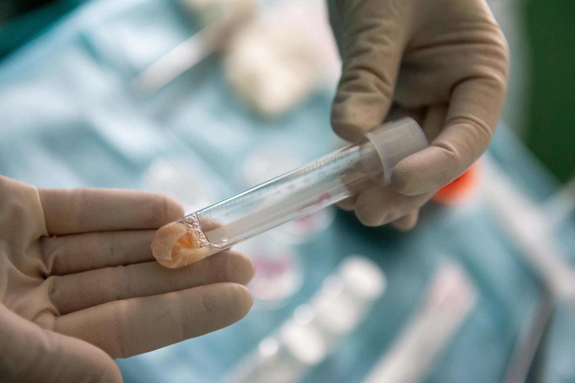 Во время операции