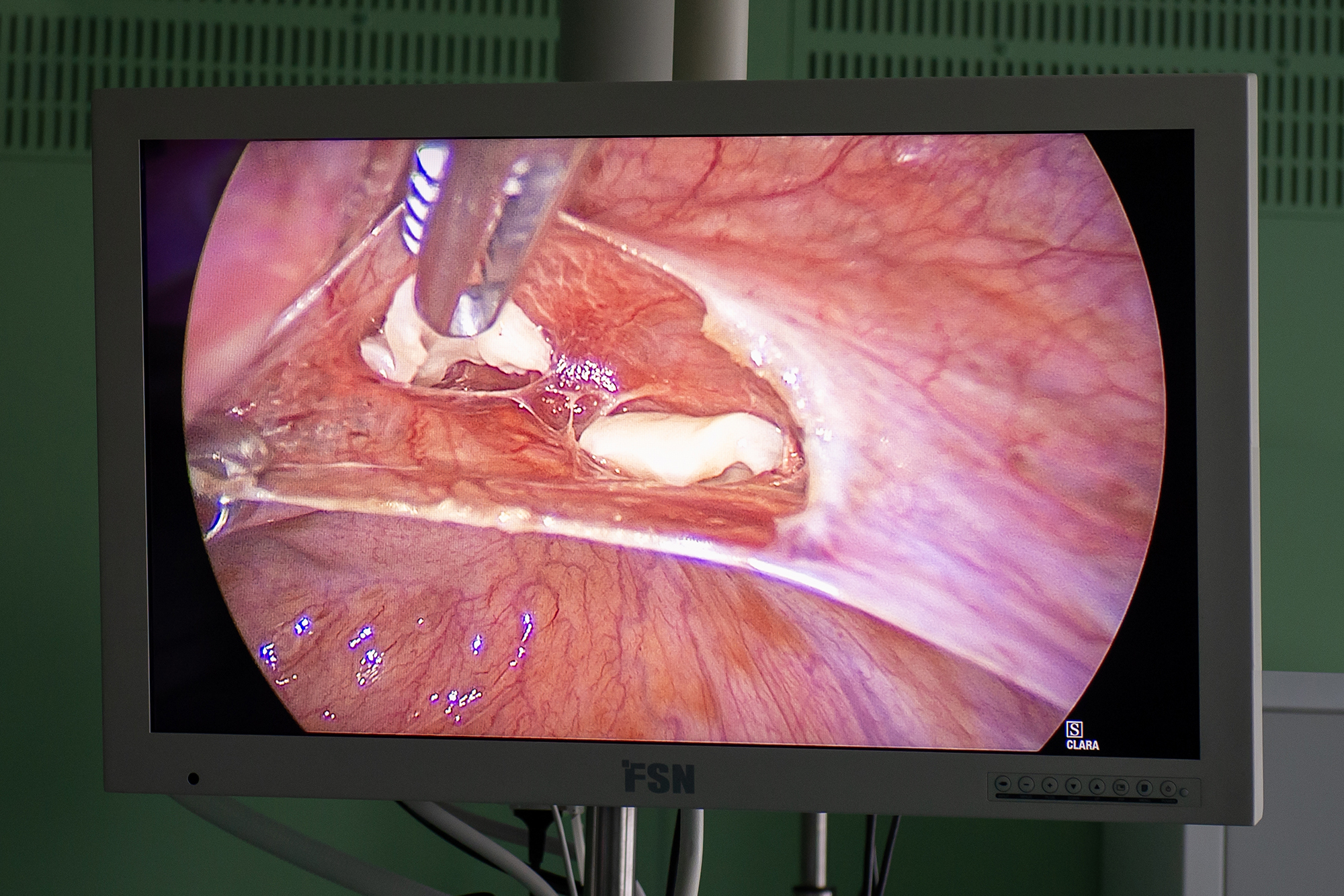 Во время операции