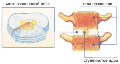 Профилактика при остеохондрозе позвоночника